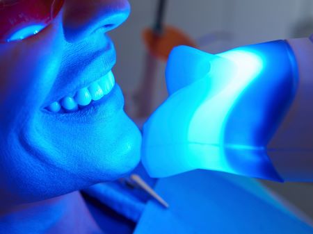 Teeth Whitening Near Me Clackamas OR