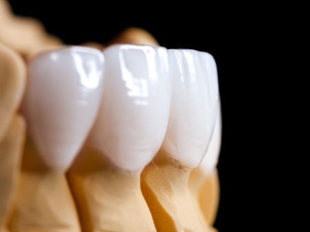 Dental Implants Clackamas Or